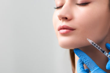 Filler injectables (Teosyal, Juvederm)